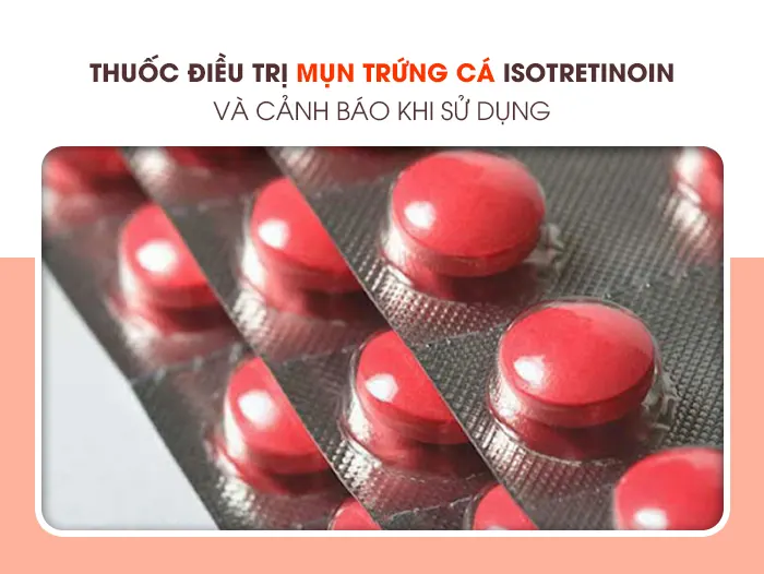 Thuốc điều trị mụn trứng cá Isotretinoin và cảnh báo khi sử dụng